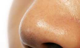 【酈致美膚團】毛孔粗大的原因和果酸換膚對毛孔粗大的改善效果介紹